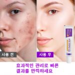 12% 아젤-라-산 크림|지성 피부|피지/모공 관리/잡티 케어|무자극 데일리 톤업 크림 DIDAHOME 상품 이미지 3